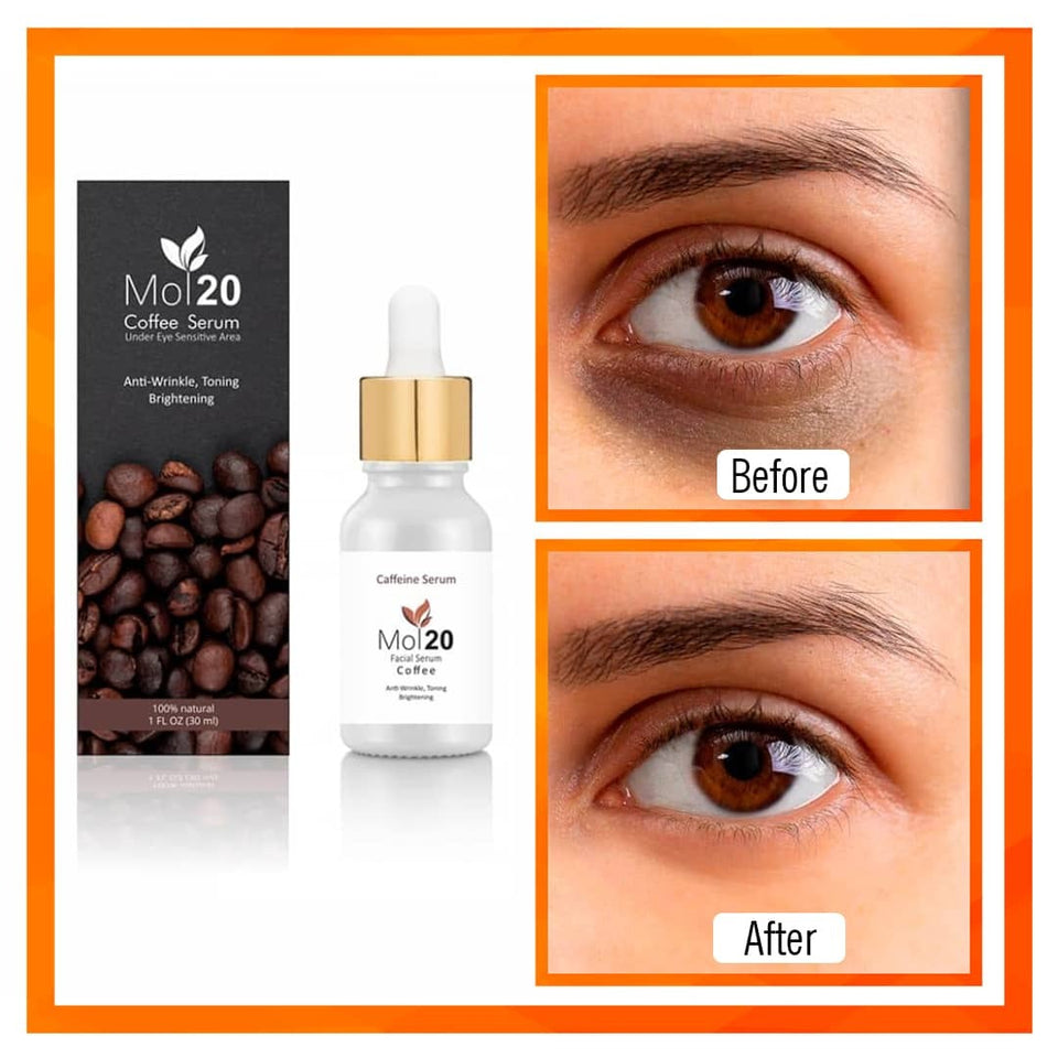 Mol20 Coffee Serum – Anti-Wrinkle & Dark Circle Remover for Youthful Eyes | 5% Caffeine & EGCG, Vegan, Free-From Formula | 100ml