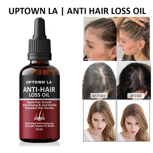 Uptown LA Anti Hair Loss Hair Regrowth Oil 100 ml