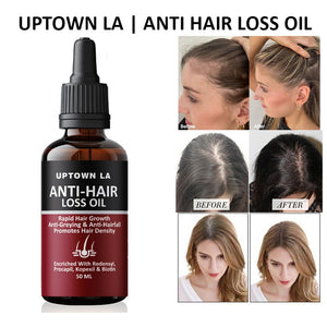 Uptown LA Anti Hair Loss Hair Regrowth Oil 100 ml