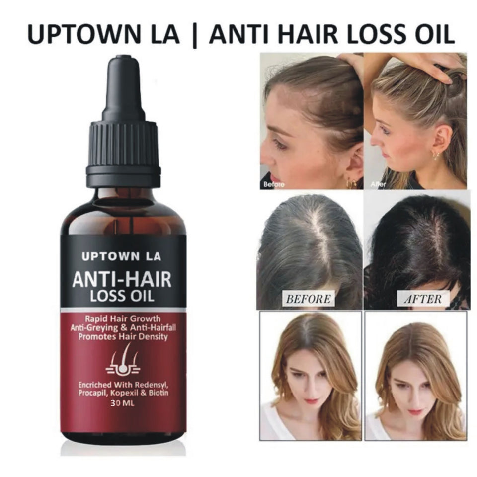 Uptown LA Anti Hair Loss Hair Regrowth Oil 100 ml