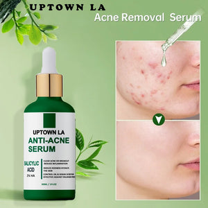 UPTOWN LA Anti Acne serum with Salicylic Acid for oil Control and acne removal 100 ml