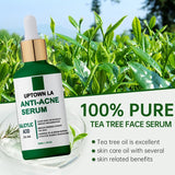UPTOWN LA Anti Acne serum with Salicylic Acid for oil Control and acne removal 100 ml