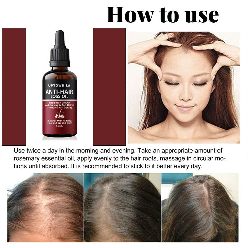 Uptown LA Anti Hair Loss Hair Regrowth Oil 100 ml