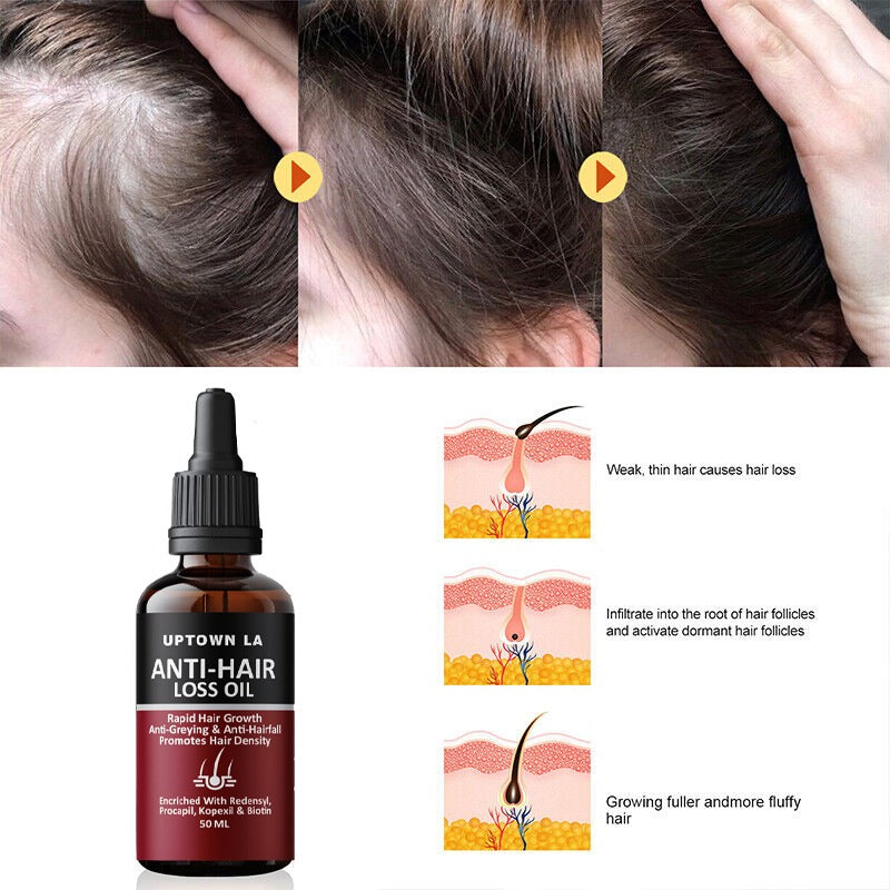 Uptown LA Anti Hair Loss Hair Regrowth Oil 100 ml