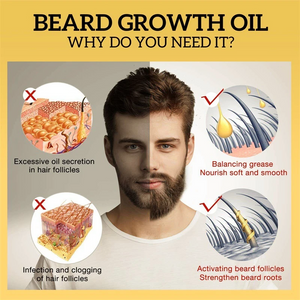 UPTOWN LA Beard Growth Oil for Men | Beard Growth Guaranteed with Argan & Geranium For faster Growth | For Beard Growth | Softness| Shine | Patchy Beard | 100 ML