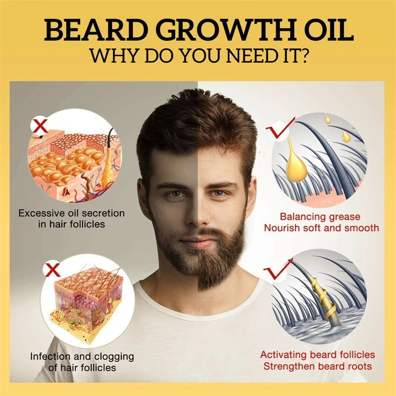 UPTOWN LA Beard Growth Oil for Men | Beard Growth Guaranteed with Argan & Geranium For faster Growth | For Beard Growth | Softness| Shine | Patchy Beard | 100 ML